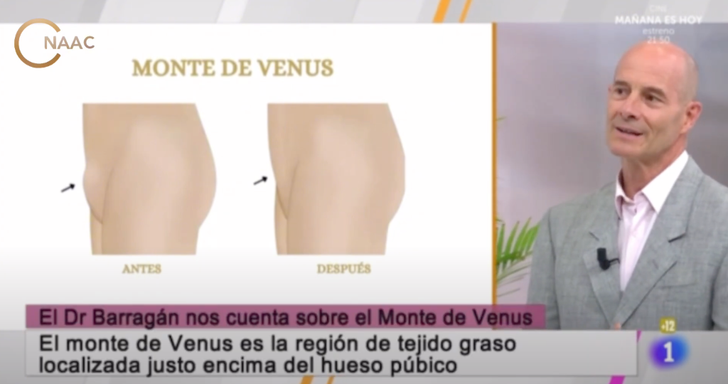 Imagen Galería