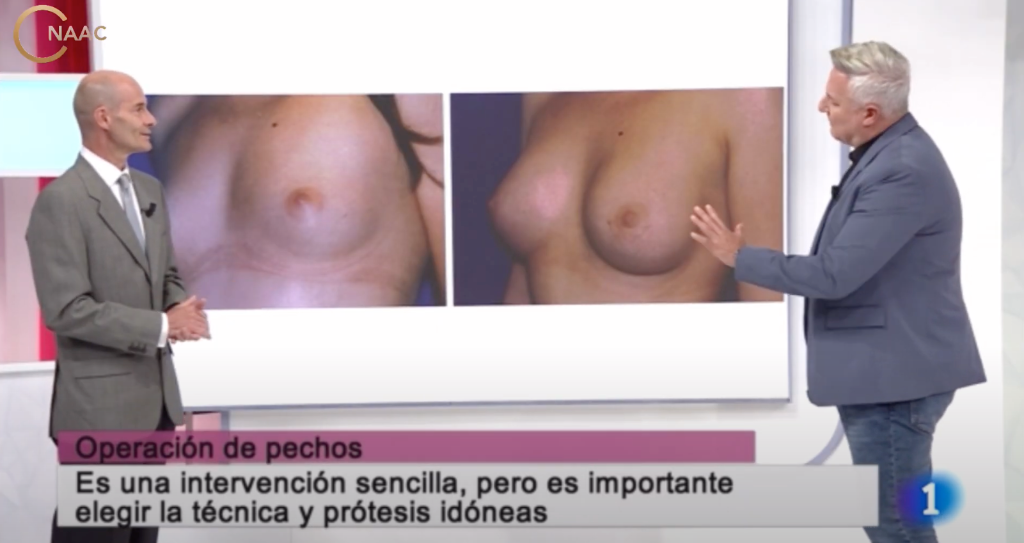 Imagen Galería